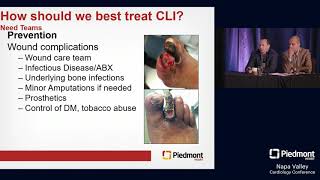 Best Treatment for Critical Limb Ischemia [upl. by Tartaglia]