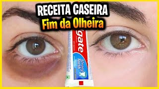 Como Acabar Com Olheira Naturalmente 5 Formas  Como Tirar Olheira I Oficina do Drama [upl. by Jen]