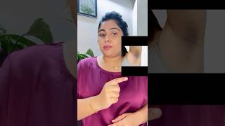 Hyperpigmentation neckarmpitsgroin areaAcanthosis Nigricanspharmcy products youtubeshorts [upl. by Rosane903]