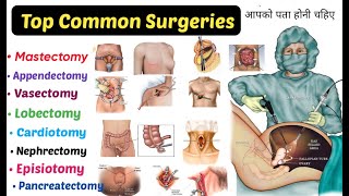 Top 15 Common Surgeries  You Should Know  mastectomy Appendectomy Lobectomyamp More [upl. by Otrebla58]