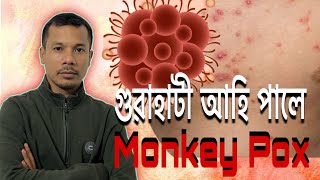 গুৱাহাটীত আক্ৰমন Monkey Pox Virus ৰ 🦠 🦠🦠🤒🤒 [upl. by Rehnberg319]