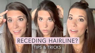 RECEDING HAIRLINE tips  tricks [upl. by Camilia399]