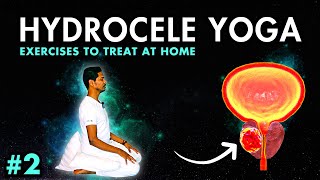 Treat Hydrocele amp Varicocele at Home Part 2  Yoga Exercises for Hydrocele amp Varicocele hydrocele [upl. by Yhtir582]