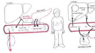 Diabetes Type II Pathophysiology [upl. by Nawek727]