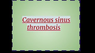 Cavernous sinus Thrombosis [upl. by Aleinad652]