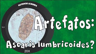 Ascaris lumbricoides ou artefato [upl. by Merrily]