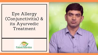 Ayurvedic treatment of eye and skin allergy [upl. by Ttereve]