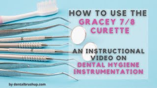 How to use the Gracey 78 Curette [upl. by Ewnihc]