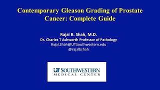 Contemporary Gleason Grading of Prostate Cancer  Complete Guide [upl. by Niveg]