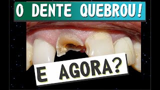 Ep 45  Meu dente quebrou e Agora [upl. by Enitsirc261]