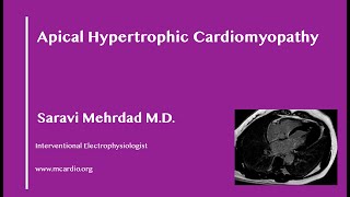 Apical Hypertrophic Cardiomyopathy [upl. by Brody798]