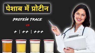 पेशाब में प्रोटीन  Protein In Urine  Urine me protein trace  Peshab me protein trace kya hota hai [upl. by Willa]