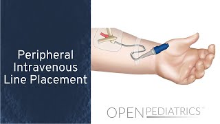 Peripheral Intravenous Line Placement by B Johnson L DelSignore  OPENPediatrics [upl. by Nirag520]