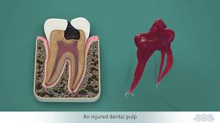 Endodontic treatments [upl. by Polk75]