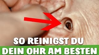 SO reinigst DU dein OHR richtig  OHRENSCHMALZ SICHER ENTFERNEN [upl. by Tnahs]