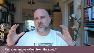 AskJJ Can you remove a Cyst from the scalp [upl. by Anaiek]