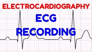 04 ECG RECORDINGELECTROCARDIOGRAPHY  ECG  CARDIOVASCULAR PHYSIOLOGY [upl. by Brice]