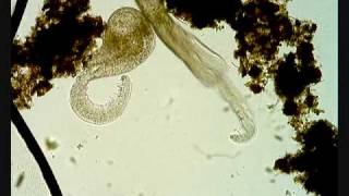 Cercaria parasite larval trematode [upl. by Annaehs]