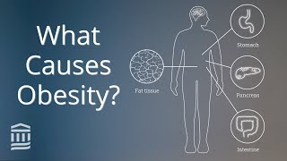 Obesity Causes Health Conditions and Treatment  Mass General Brigham [upl. by Yleek257]