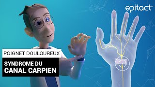 Syndrome du Canal Carpien  Explications – EPITACT [upl. by Gnirps]