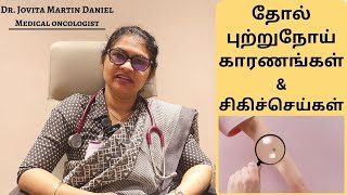 Melanoma Cancer in tamil  Causes  Symptoms Treatment  Dr Jovita Martin Daniel [upl. by Lona]