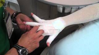 Arm Lymphedema wrapping [upl. by Besnard201]