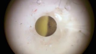 Frog oocyte microinjection [upl. by Nawor]