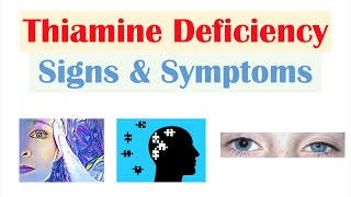 Thiamine Vit B1 Deficiency Signs amp Symptoms amp Why They Occur [upl. by Aener]