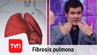 Todo lo que debes saber sobre la fibrosis pulmonar  Muy buenos días  Buenos días a todos [upl. by Ringler]