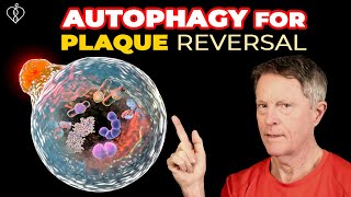 Reversing Arterial Plaque With Autophagy part 1 [upl. by Yentroc291]