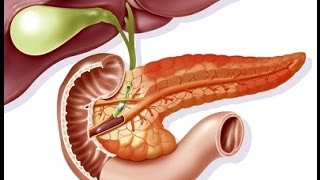 Acute Pancreatitis [upl. by Lakin804]