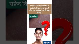 सफ़ेद तिल और सफ़ेद दाग़ में फर्क Idiopathic Guttate Hypomelanosis amp Vitiligo igh vitiligo leucoderma [upl. by Theona]