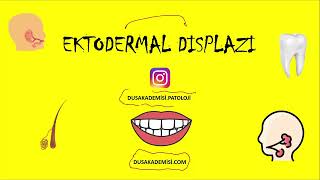 Ektodermal Displazi ve İnkontinentia Pigmenti [upl. by Elkin955]