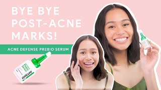 Oxecure Acne Defense Prebio Serum Visibly fade postacne marks in as fast as 1 week [upl. by Spiros]