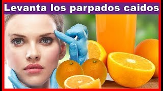 Resuelve tu problema de parpados caídos de forma natural [upl. by Lednyc426]