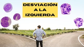 Desviación a la Izquierda en el Hemograma [upl. by Phillipp]