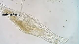 quotBdelloid Rotifer The Tiny Survivor That Defies Agingquot [upl. by Sura]