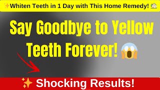 Best Home Remedy for Teeth Whitening  Natural Home Remedies for Teeth Whitening  Tartar Removal [upl. by Publia310]