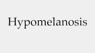 How to Pronounce Hypomelanosis [upl. by Einnaj]