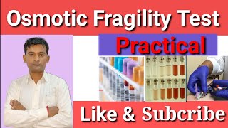 Osmotic Fragility Test Practical Surendra Tech Study [upl. by Adnoraj208]