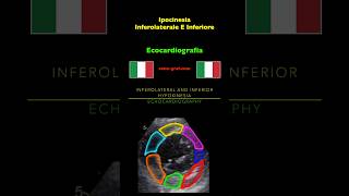 Ecocardiografia  Ipocinesia Inferolaterale E Inferiore [upl. by Josefa647]