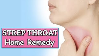 How To get Rid Of Strep Throat Without Antibiotics  Home Remedies For Strep Throat [upl. by Inavihs]