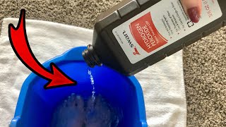 Put Hydrogen Peroxide on your FEET amp SEE WHAT HAPPENS 💥 this is cool and surprising [upl. by Ecinnej]