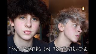 2 MONTHS ON T FTM TRANSGENDER  NOAHFINNCE [upl. by Arramas]