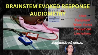 209Brainstem Evoked Response Audiometry BERA Part 12 brain auditory evoked response bera [upl. by Eurydice]