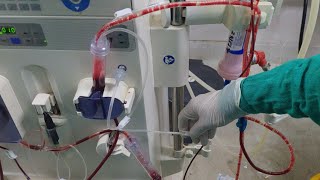 Air embolism during dialysis How to remove air during dialysis [upl. by Radcliffe885]