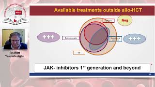 Allogeneic Stem Cell Transplantation for Myelofibrosis [upl. by Atnahsal752]