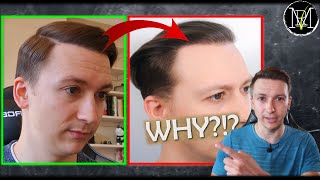 Hair Transplant Falling Out Heres WHY [upl. by Tivad709]