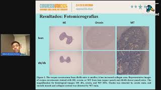 Caracterização histomorfométrica do corpo cavernoso associado ao diabetes mellitus [upl. by Eidak]