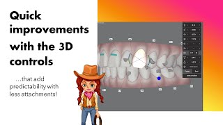 Invisalign ClinCheck edited and made easier with the 3D controls [upl. by Roderich]